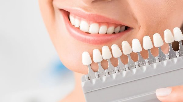 bahçelievler diş beyazlatma tedavisi, diş beyazlatma tedavisi bahçelievler, bahçelievler estetik diş hekimliği