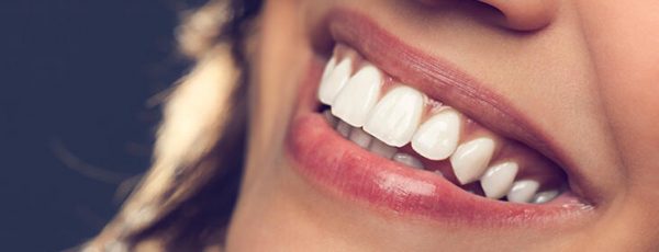 klinik afm diş beyazlatma tedavisi bahçelievler, bahçelievler diş beyazlatma tedavisi