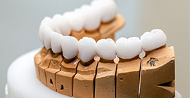 Protez Diş Tedavisi Bahçelievler, bahçelievler protez diş tedavisi, protez diş tedavisi incirli, incirli protez diş tedavisi