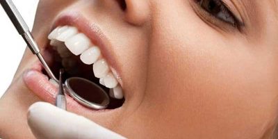 Laminasyon Sonrası Diş Bakımı Nasıl Olmalıdır?