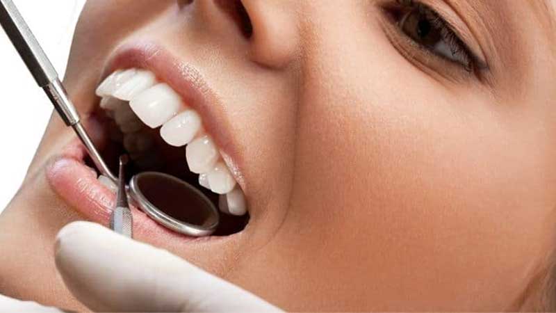 Laminasyon Sonrası Diş Bakımı Nasıl Olmalıdır?